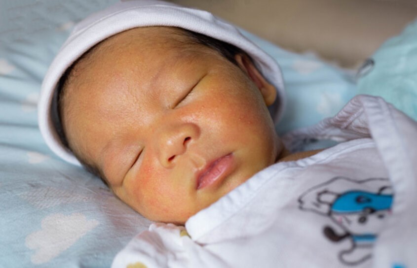Trẻ sơ sinh có thể bị vàng da từ rất sớm - Nguồn: unsplash