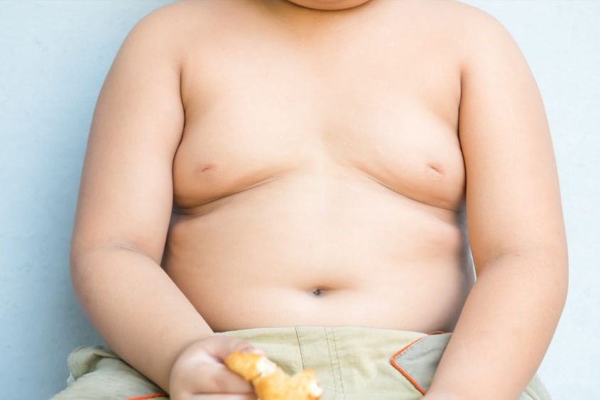 Bệnh béo phì ở trẻ em ngày càng gia tăng