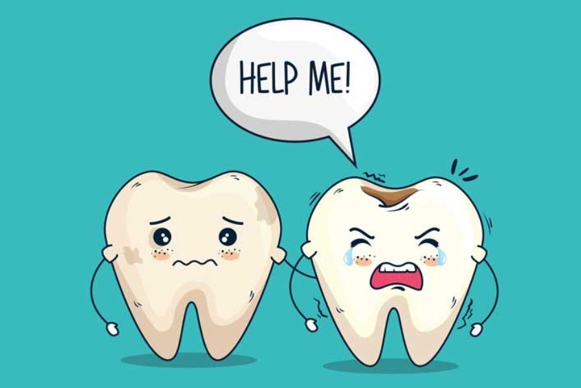 Răng sữa bị sâu sâu răng là gì