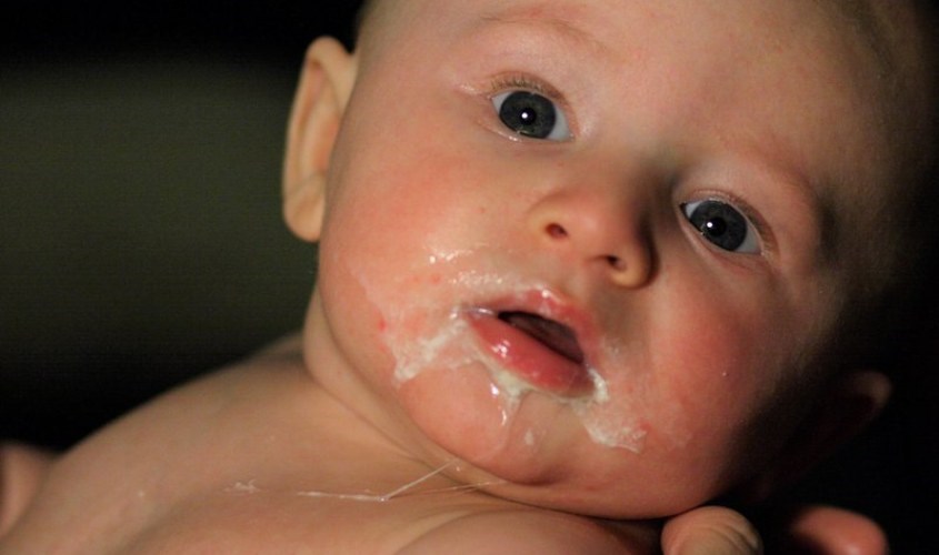Dính thắng môi trên làm trẻ khó ăn uống